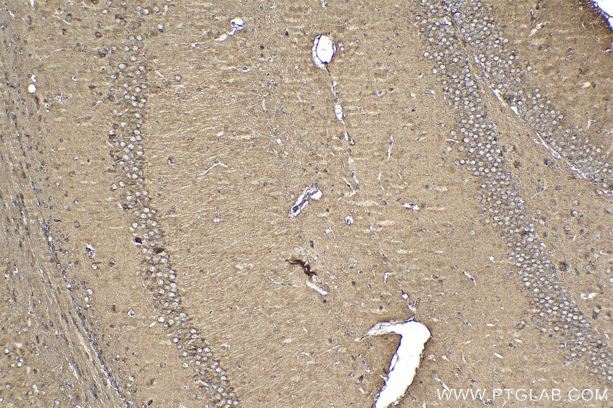 Immunohistochemistry (IHC) staining of mouse brain tissue using SORLA Polyclonal antibody (22592-1-AP)