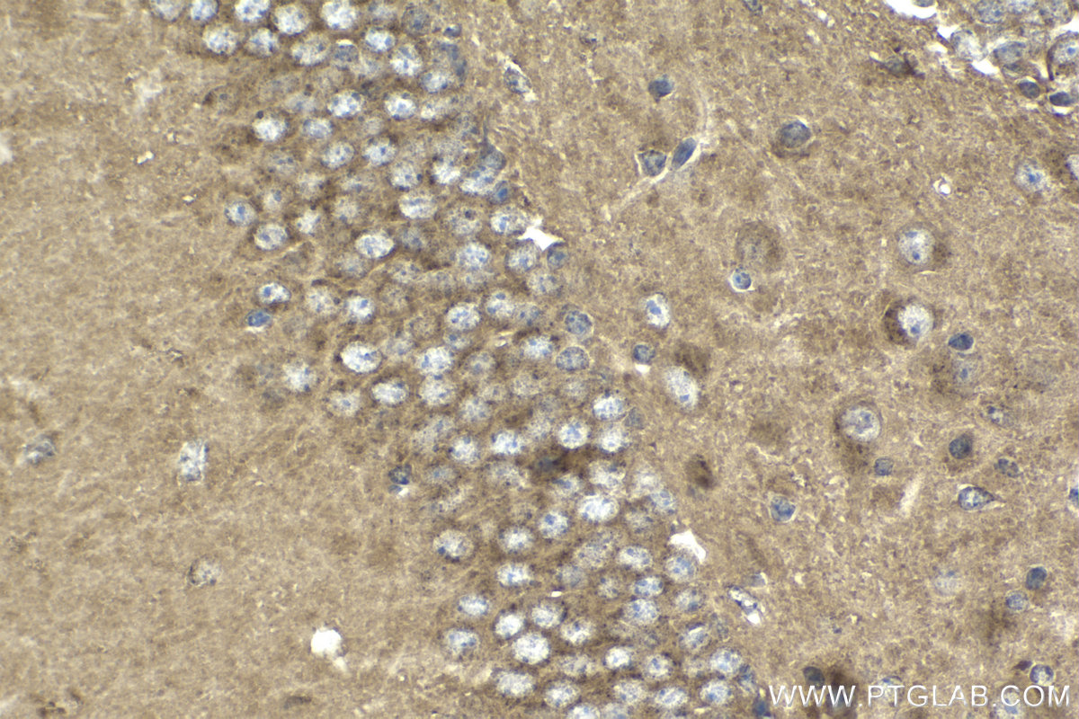 Immunohistochemistry (IHC) staining of mouse brain tissue using SORLA Polyclonal antibody (22592-1-AP)