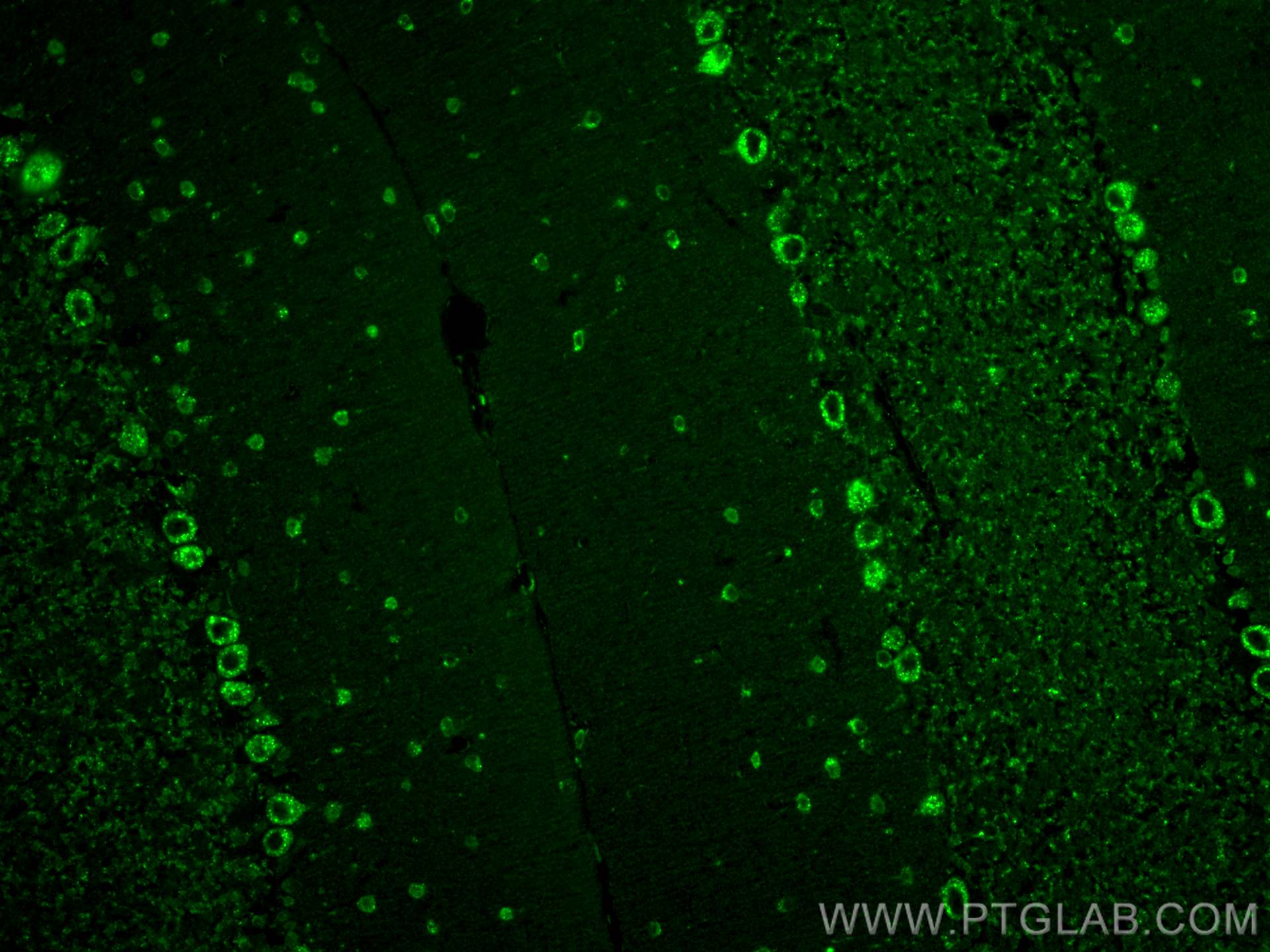 Immunofluorescence (IF) / fluorescent staining of mouse cerebellum tissue using SORLA Monoclonal antibody (68651-1-Ig)