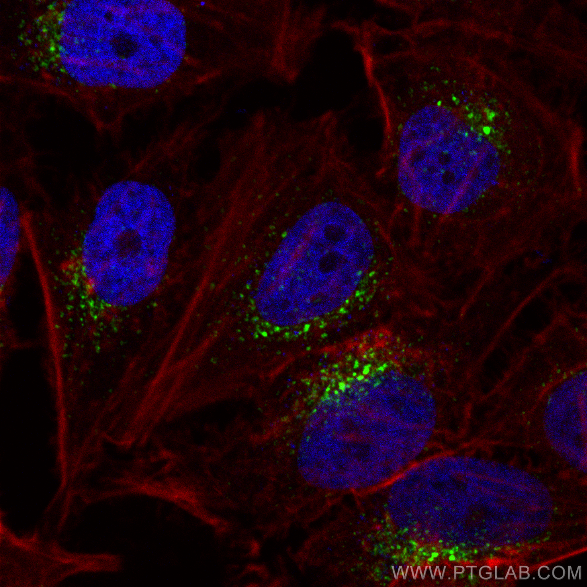 Immunofluorescence (IF) / fluorescent staining of HeLa cells using Sortilin Polyclonal antibody (12369-1-AP)