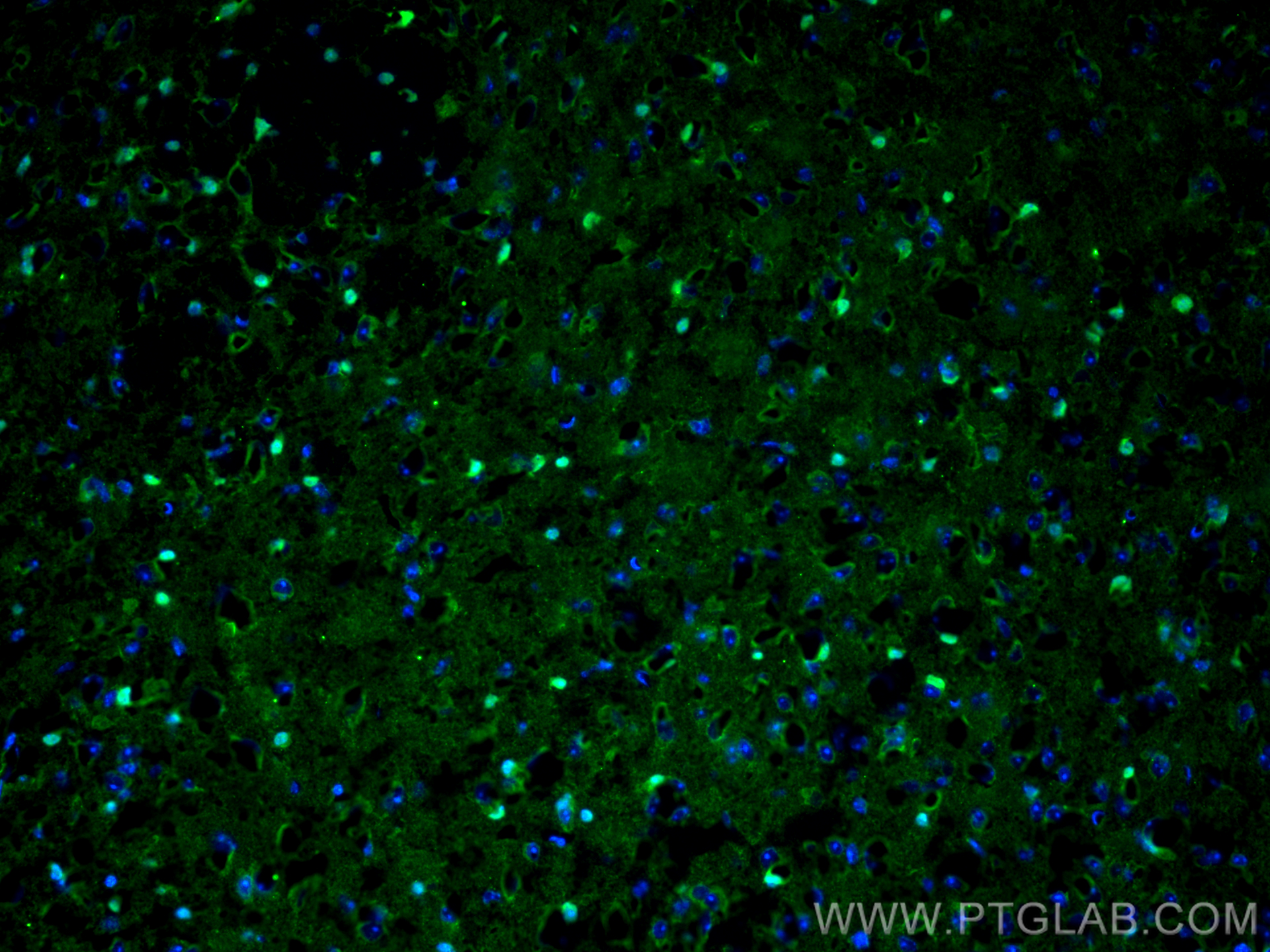 Immunofluorescence (IF) / fluorescent staining of mouse brain tissue using SOX10 Polyclonal antibody (10422-1-AP)