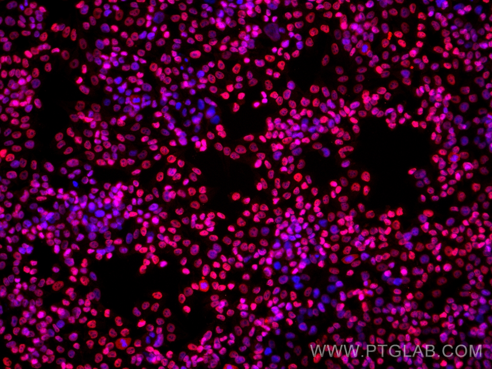 Immunofluorescence (IF) / fluorescent staining of A375 cells using SOX10 Monoclonal antibody (66786-1-Ig)