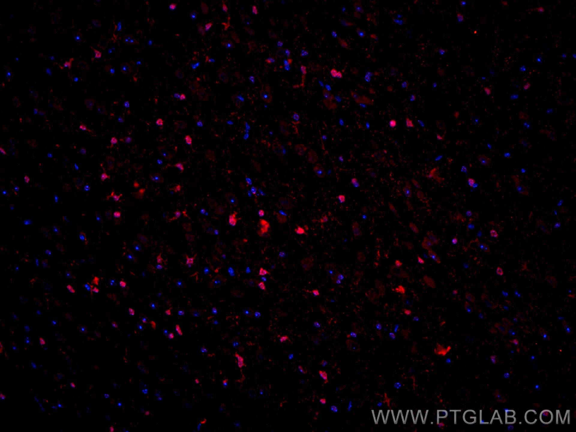 Immunofluorescence (IF) / fluorescent staining of mouse brain tissue using SOX2 Polyclonal antibody (11064-1-AP)