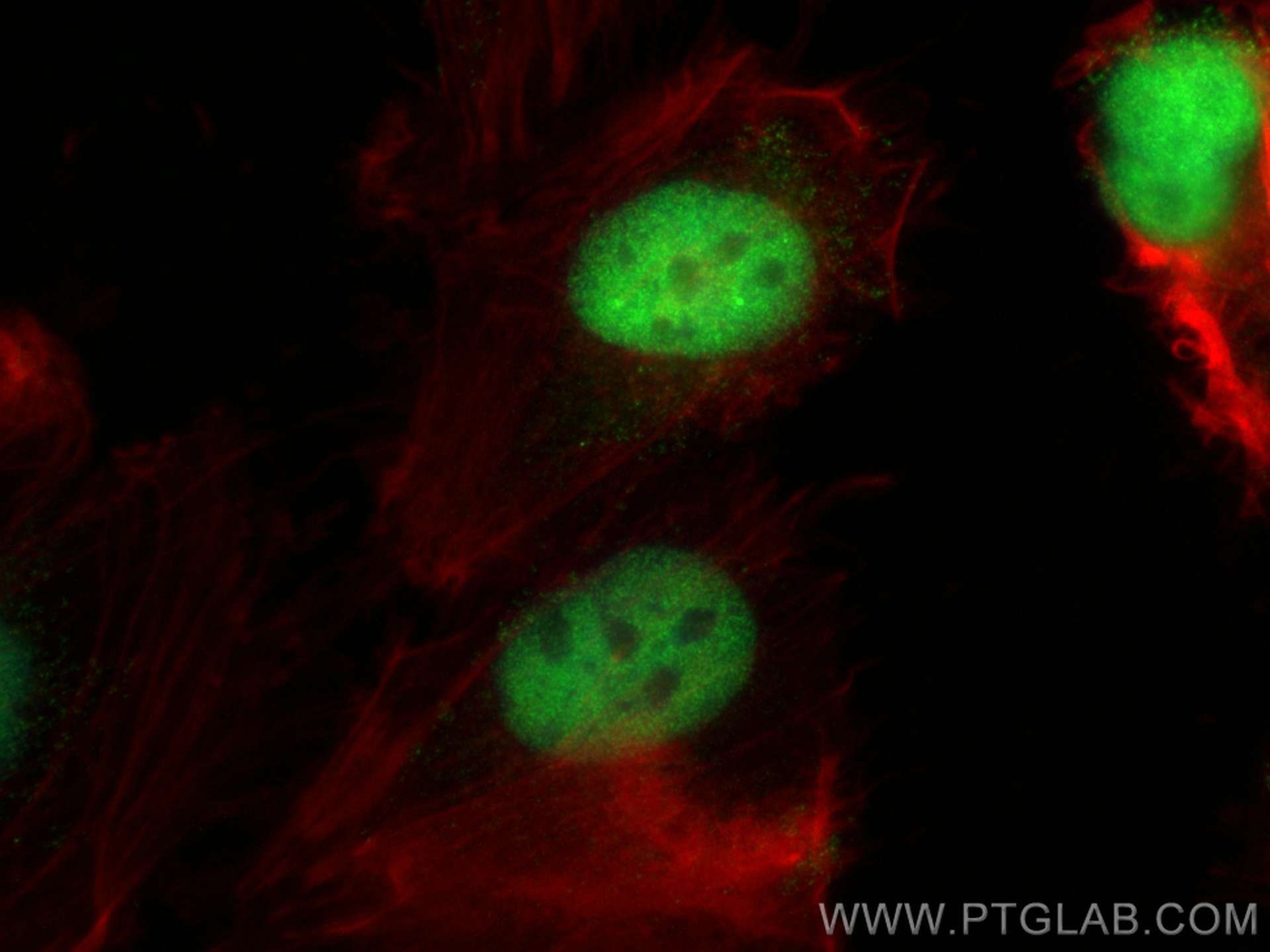 Immunofluorescence (IF) / fluorescent staining of U-251 cells using SOX2 Polyclonal antibody (11064-1-AP)