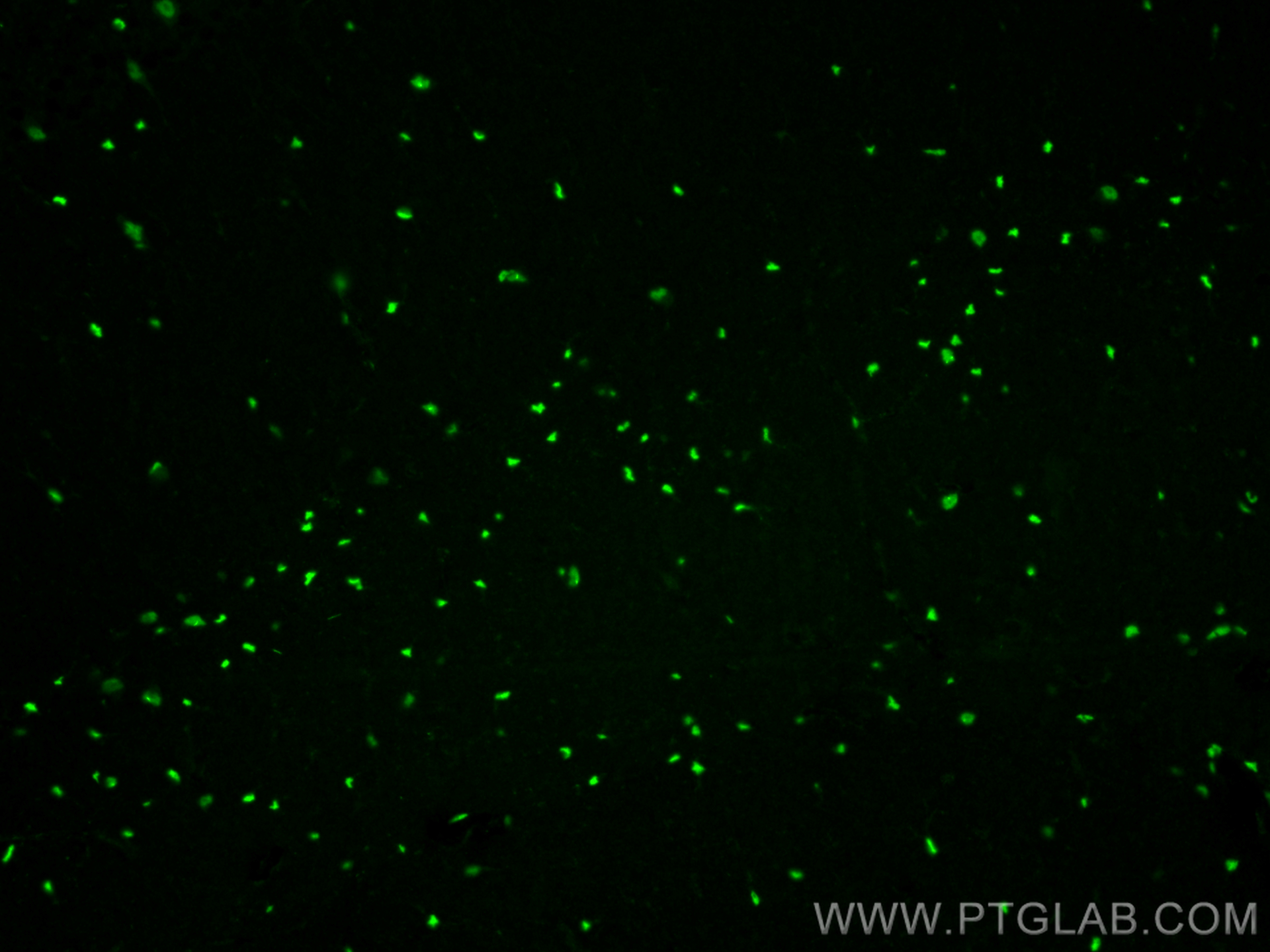 Immunofluorescence (IF) / fluorescent staining of mouse brain tissue using SOX2 Polyclonal antibody (11064-1-AP)