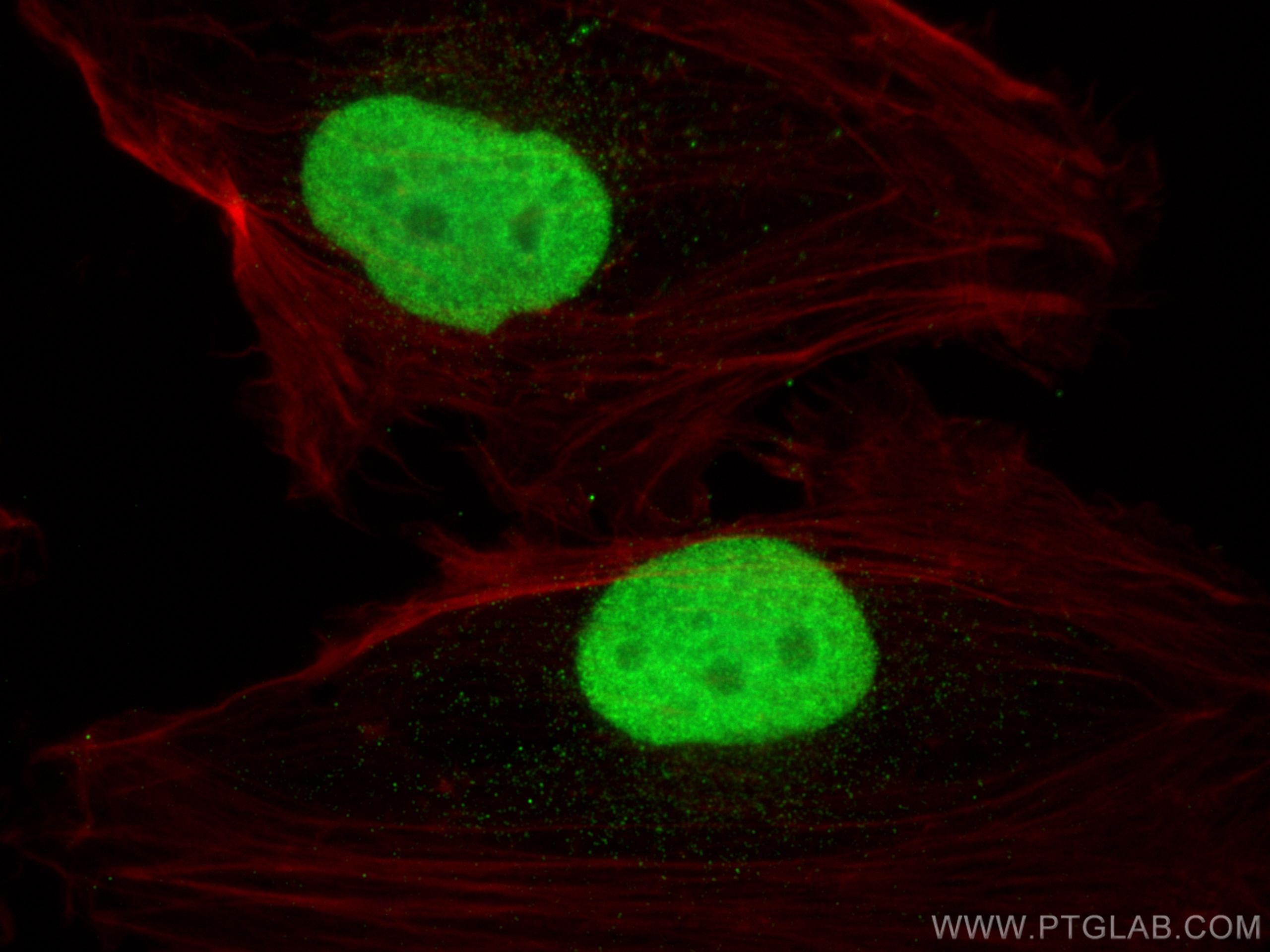 Immunofluorescence (IF) / fluorescent staining of U-251 cells using SOX2 Monoclonal antibody (66411-1-Ig)