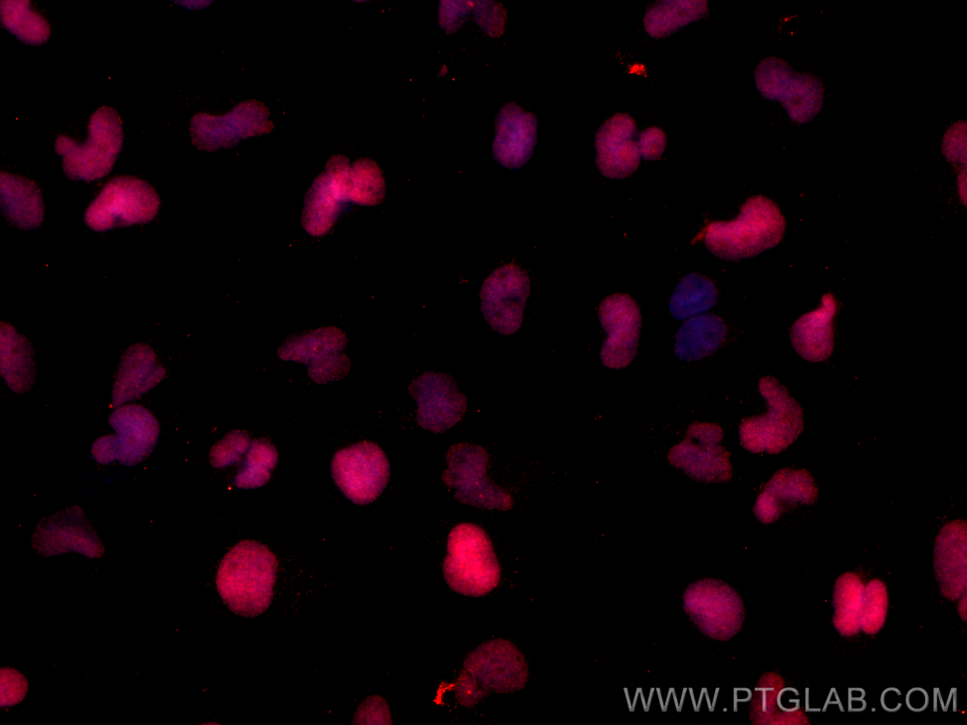 Immunofluorescence (IF) / fluorescent staining of U-251 cells using CoraLite®594-conjugated SOX2 Monoclonal antibody (CL594-66411)