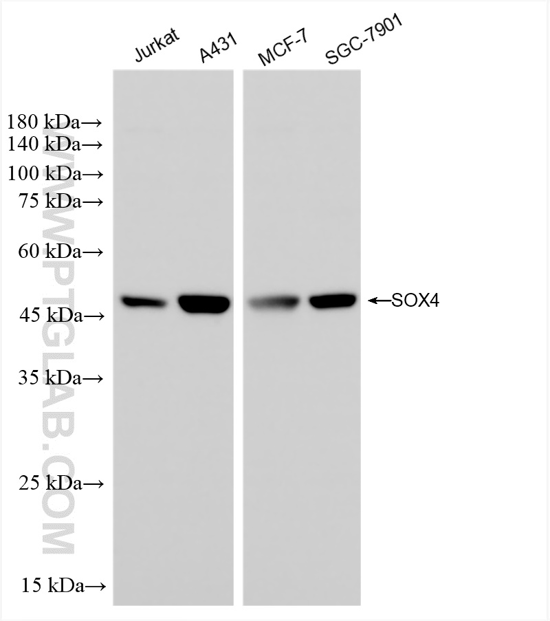 Western Blot (WB) analysis of various lysates using SOX4 Recombinant antibody (83660-1-RR)