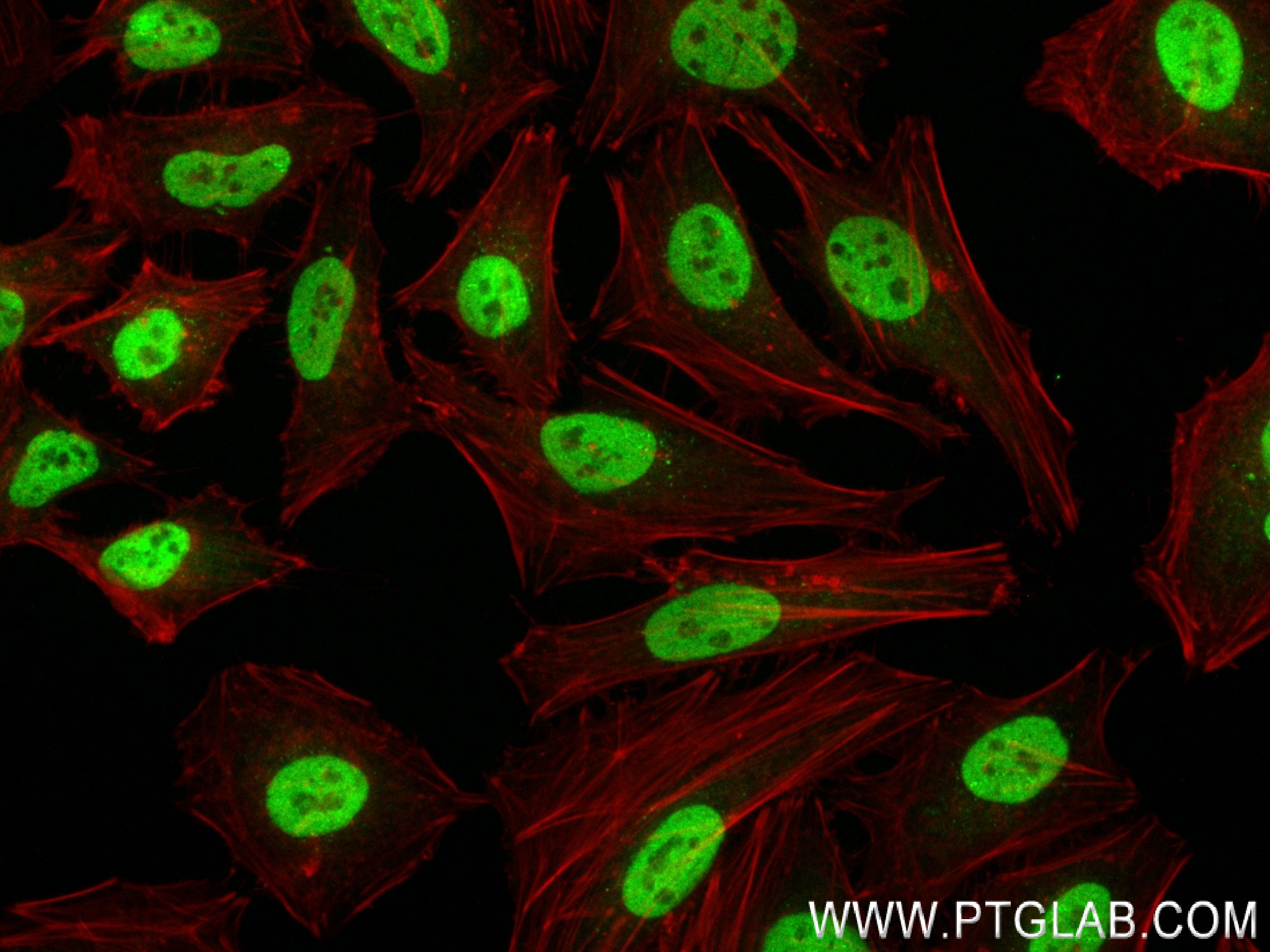 Immunofluorescence (IF) / fluorescent staining of HeLa cells using SOX8 Recombinant antibody (83238-3-RR)