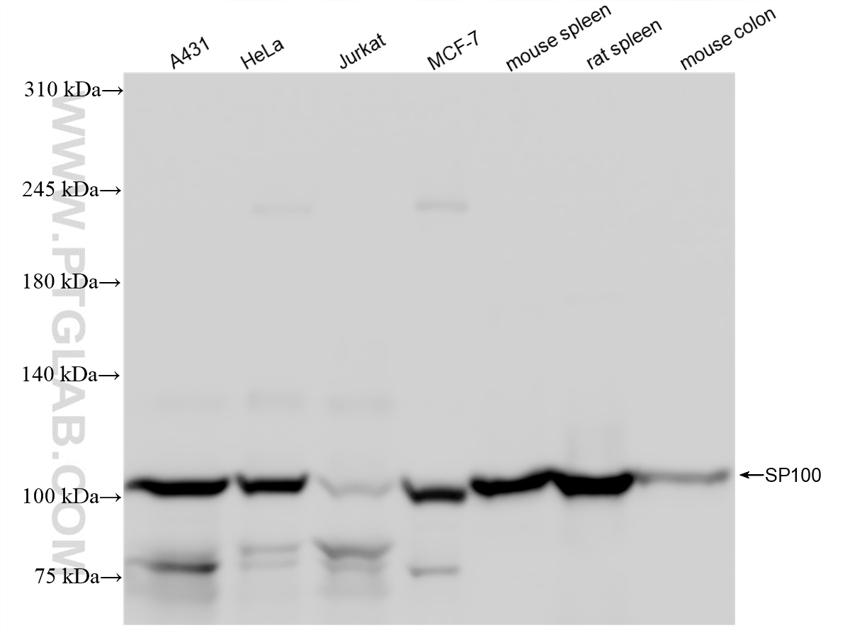 Western Blot (WB) analysis of various lysates using SP100 Recombinant antibody (84012-4-RR)