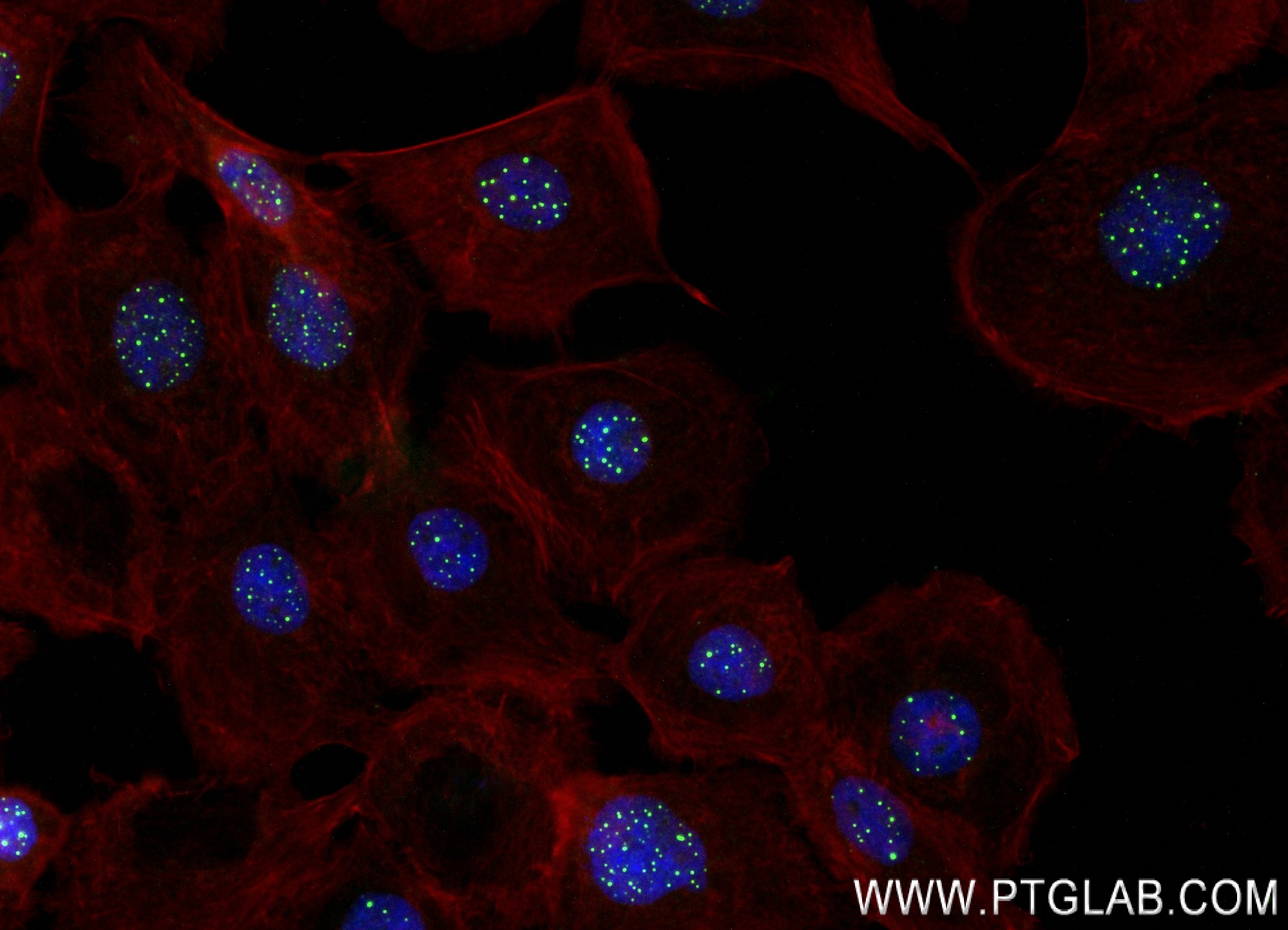 Immunofluorescence (IF) / fluorescent staining of A431 cells using SP100 Recombinant antibody (84012-5-RR)