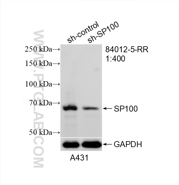 Western Blot (WB) analysis of A431 cells using SP100 Recombinant antibody (84012-5-RR)