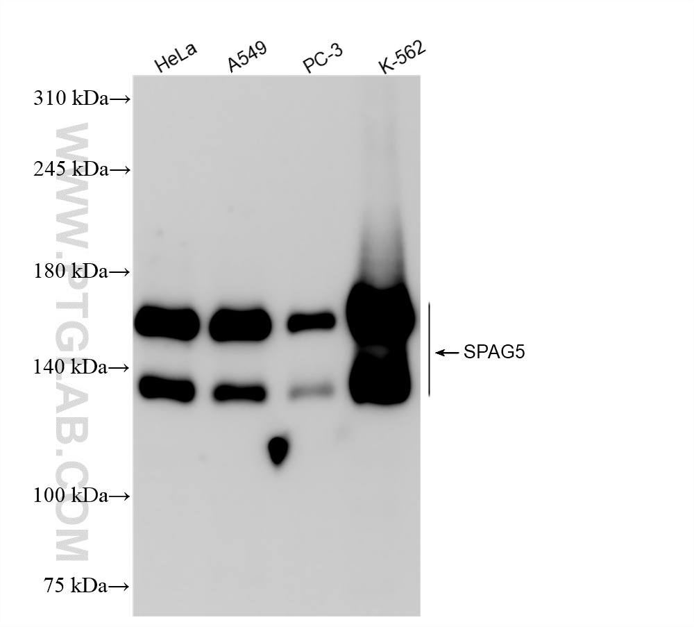 Western Blot (WB) analysis of various lysates using SPAG5 Recombinant antibody (84809-4-RR)