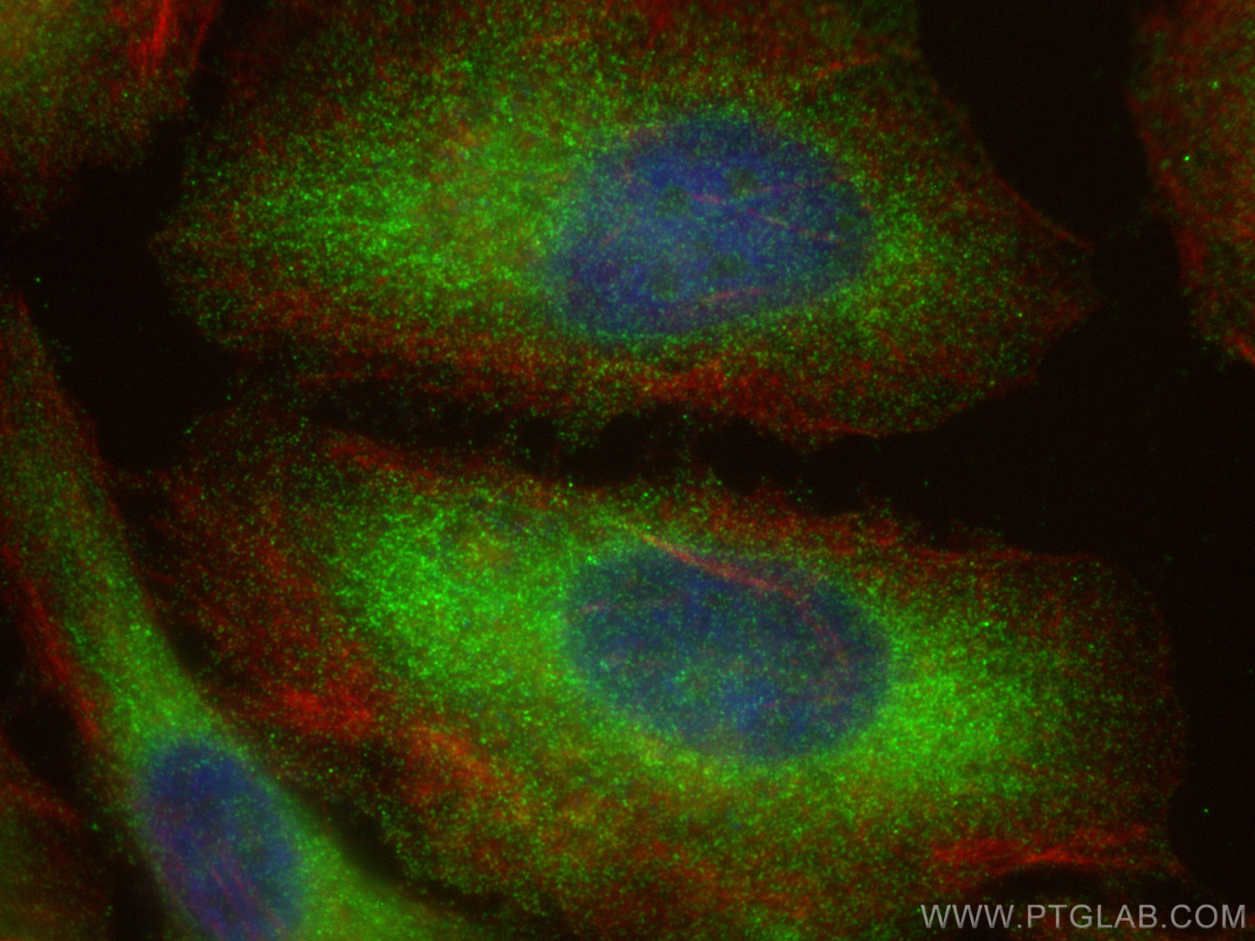 Immunofluorescence (IF) / fluorescent staining of HeLa cells using SPAG9 Polyclonal antibody (24423-1-AP)