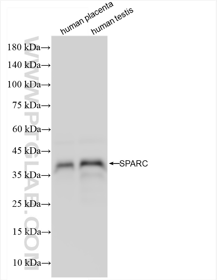 Western Blot (WB) analysis of various lysates using SPARC Recombinant antibody (84621-3-RR)