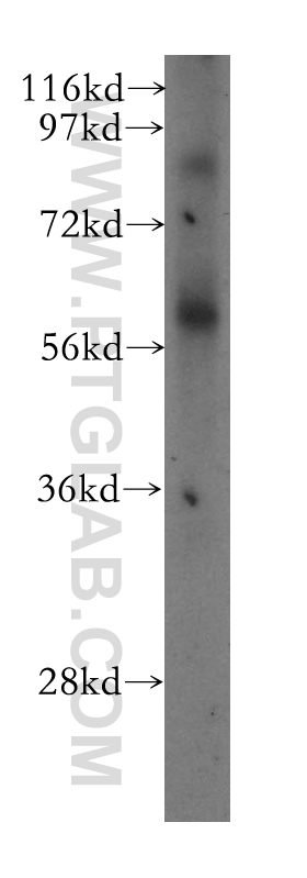 Western Blot (WB) analysis of human lung tissue using SPATA2 Polyclonal antibody (11000-1-AP)