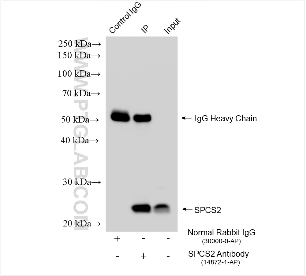 Immunoprecipitation (IP) experiment of HeLa cells using SPCS2 Polyclonal antibody (14872-1-AP)