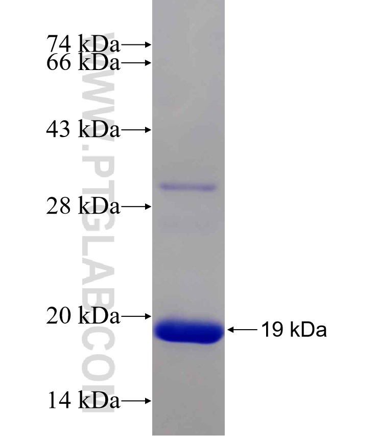 SPEG fusion protein Ag30800 SDS-PAGE