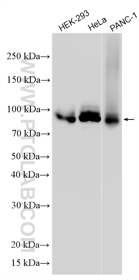 Western Blot (WB) analysis of various lysates using Spartin/SPG20 Polyclonal antibody (13791-1-AP)