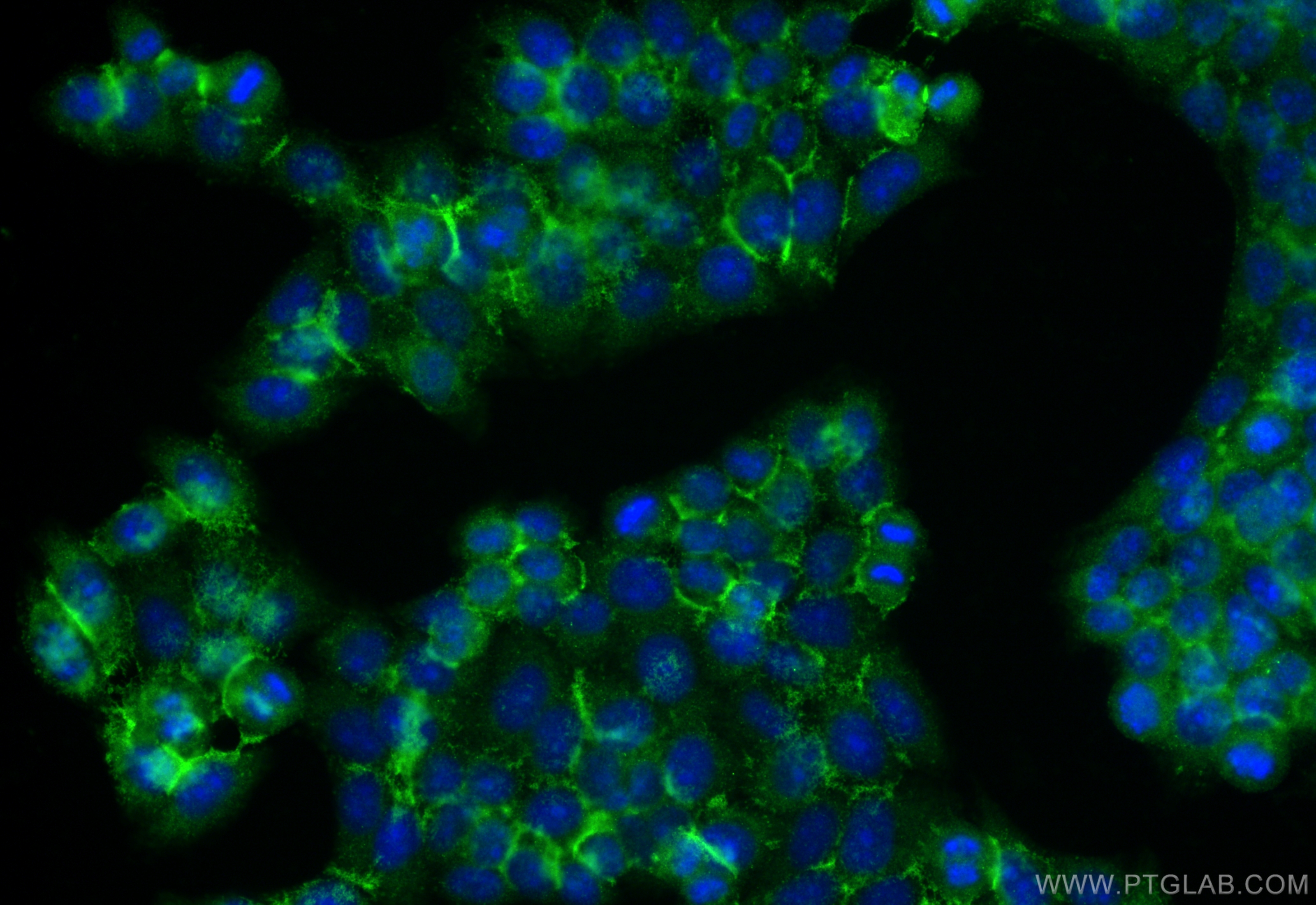 Immunofluorescence (IF) / fluorescent staining of L02 cells using SPHK1 Polyclonal antibody (10670-1-AP)