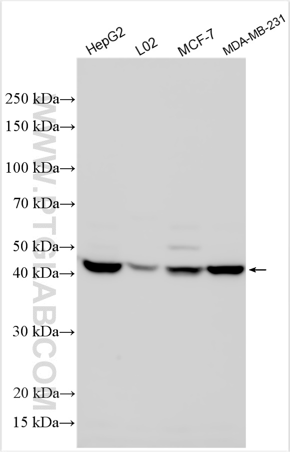 Western Blot (WB) analysis of various lysates using SPHK1 Polyclonal antibody (10670-1-AP)