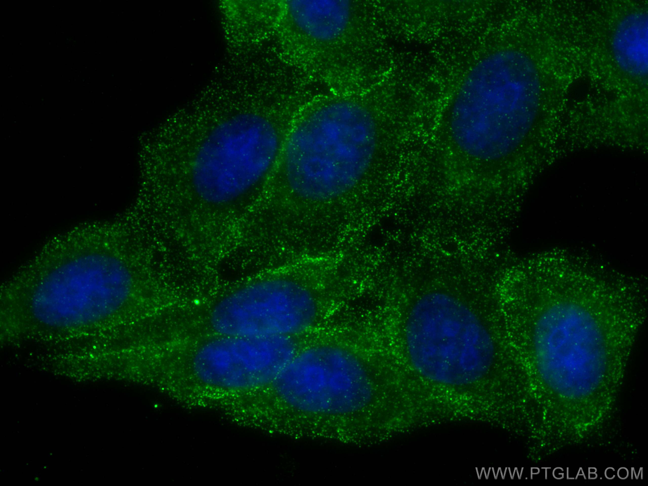 Immunofluorescence (IF) / fluorescent staining of HepG2 cells using SPHK1 Recombinant antibody (82609-1-RR)