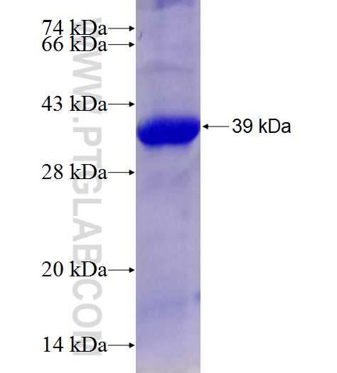 SPHK1 fusion protein Ag28391 SDS-PAGE