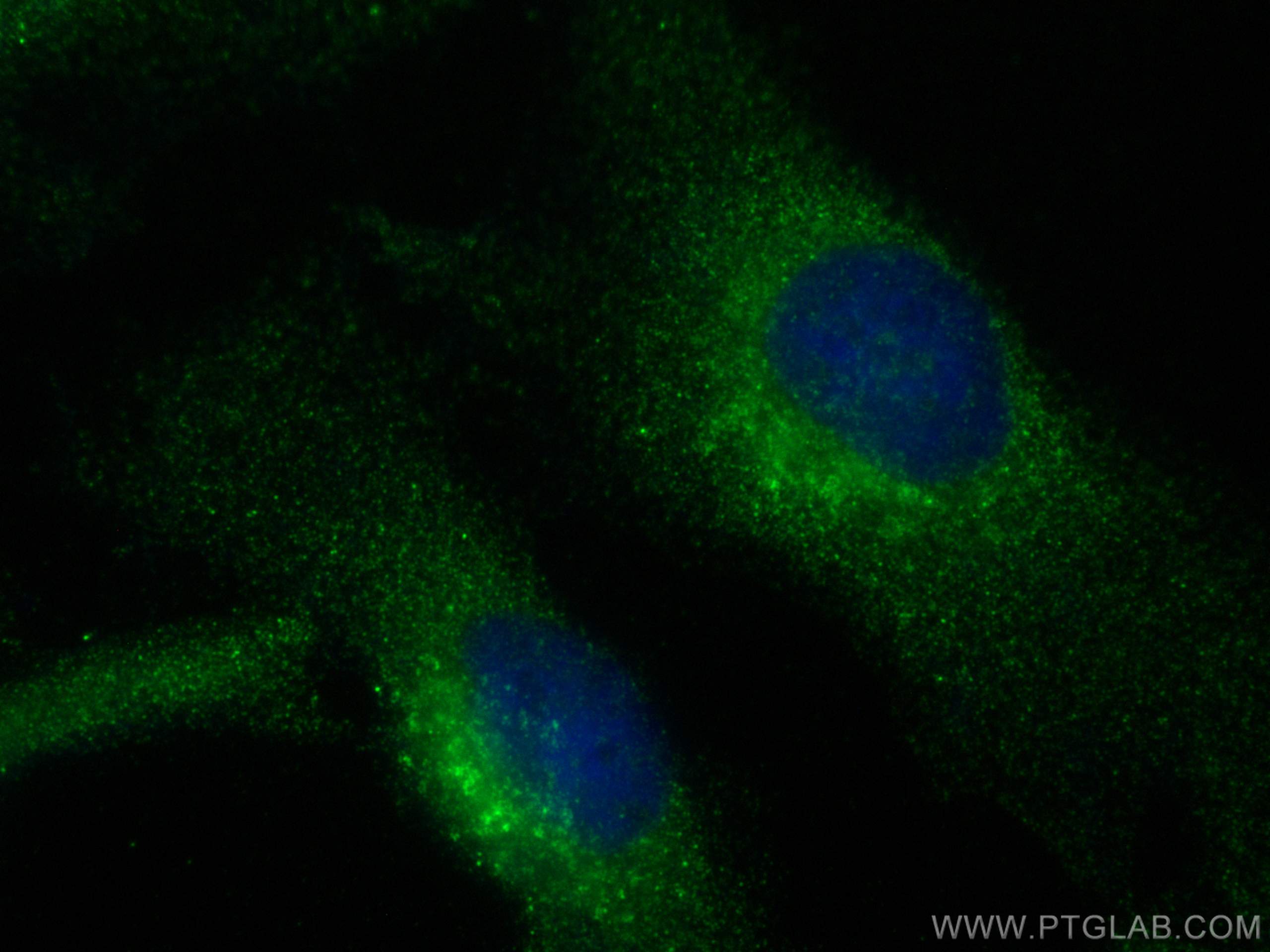 Immunofluorescence (IF) / fluorescent staining of HeLa cells using SPHK2 Polyclonal antibody (17096-1-AP)