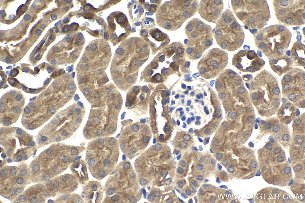 Immunohistochemistry (IHC) staining of mouse kidney tissue using SPHK2 Polyclonal antibody (17096-1-AP)