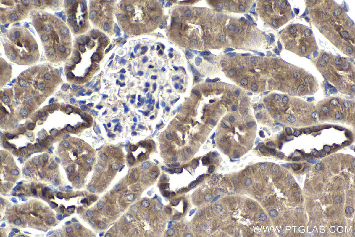 Immunohistochemistry (IHC) staining of rat kidney tissue using SPHK2 Polyclonal antibody (17096-1-AP)