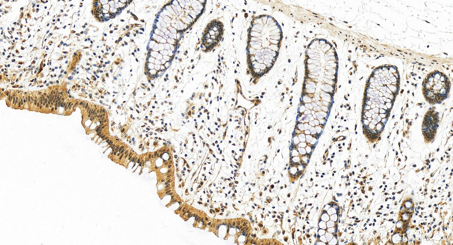 Immunohistochemistry (IHC) staining of human colon tissue using SPIN2B Polyclonal antibody (10107-2-AP)