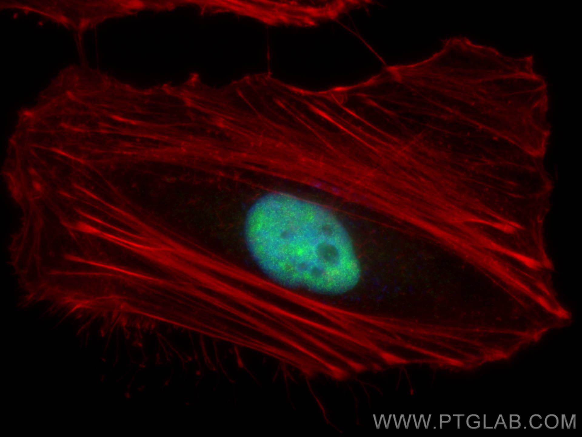 Immunofluorescence (IF) / fluorescent staining of HeLa cells using SPIN2B Polyclonal antibody (10107-2-AP)