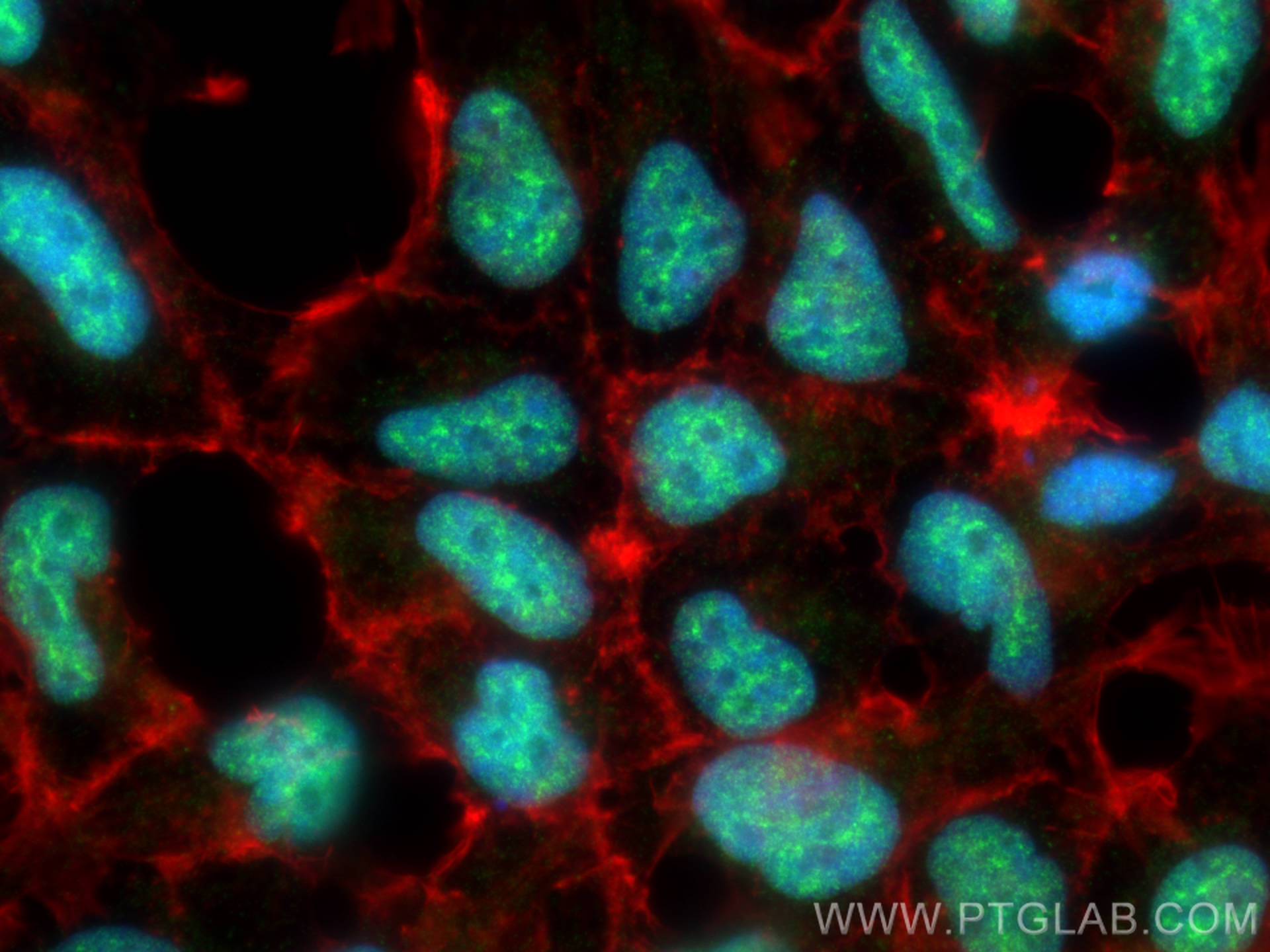 Immunofluorescence (IF) / fluorescent staining of HEK-293 cells using SPIN2B Polyclonal antibody (10107-2-AP)