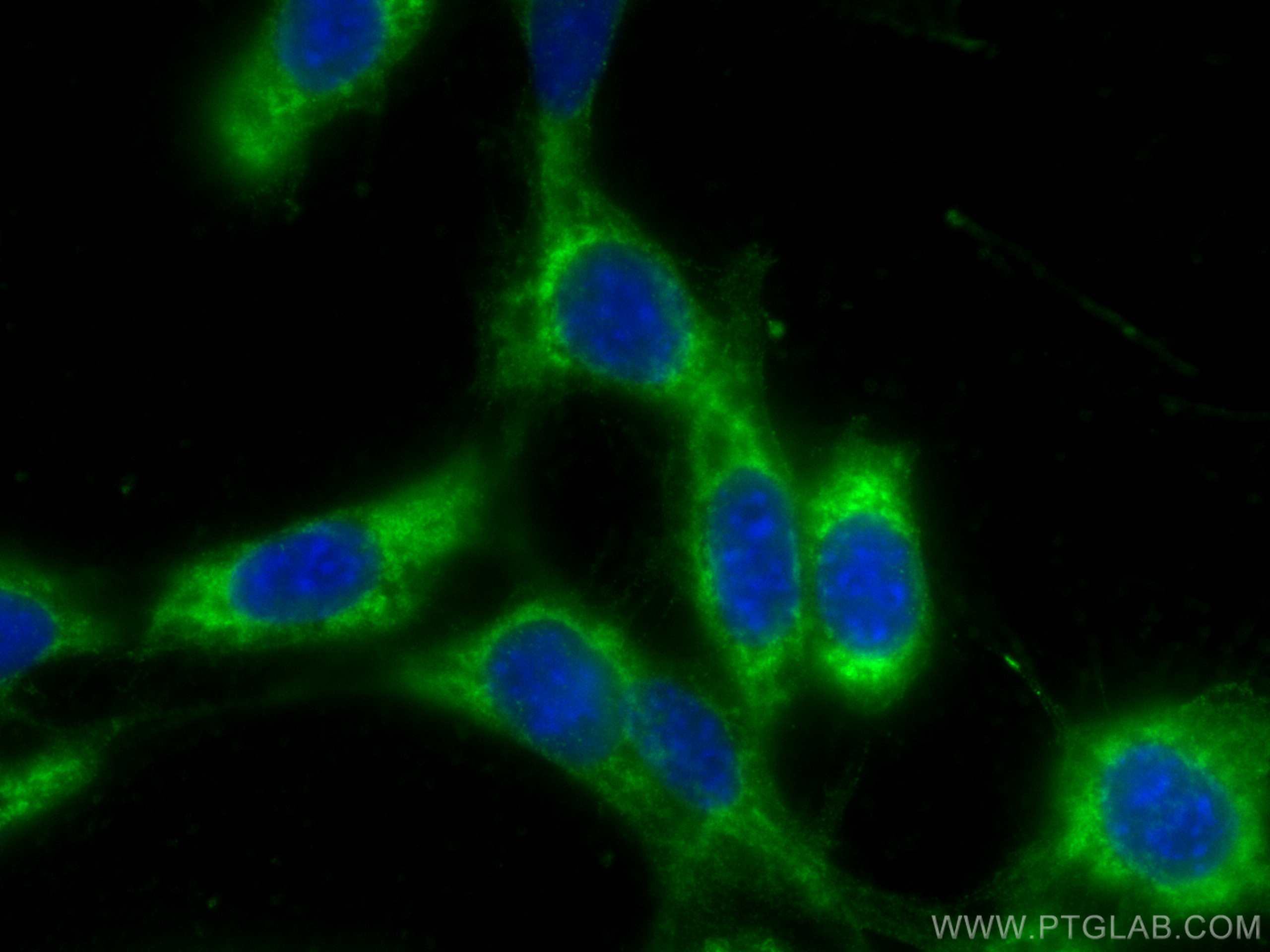 Immunofluorescence (IF) / fluorescent staining of NIH/3T3 cells using HAI-1 Polyclonal antibody (15036-1-AP)