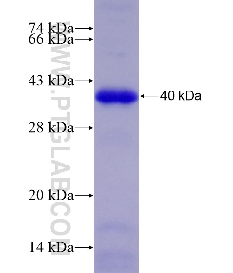 SPRY2 fusion protein Ag28599 SDS-PAGE