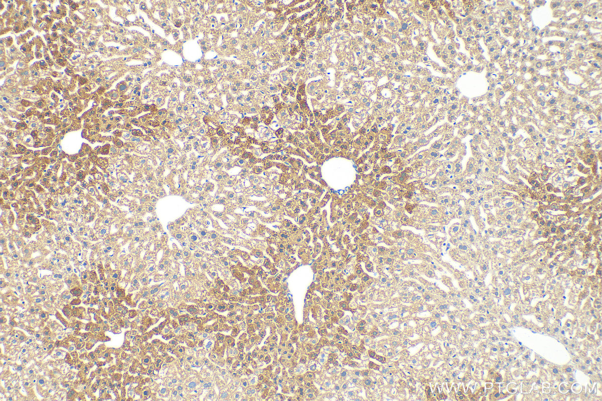 Immunohistochemistry (IHC) staining of mouse liver tissue using SPRY4 Polyclonal antibody (22765-1-AP)