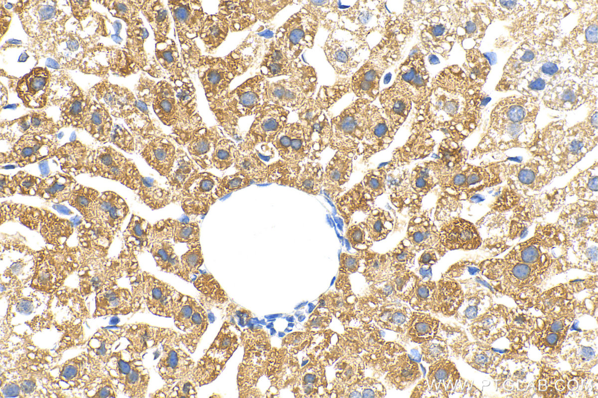 Immunohistochemistry (IHC) staining of mouse liver tissue using SPRY4 Polyclonal antibody (22765-1-AP)