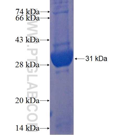 SPSB3 fusion protein Ag22887 SDS-PAGE