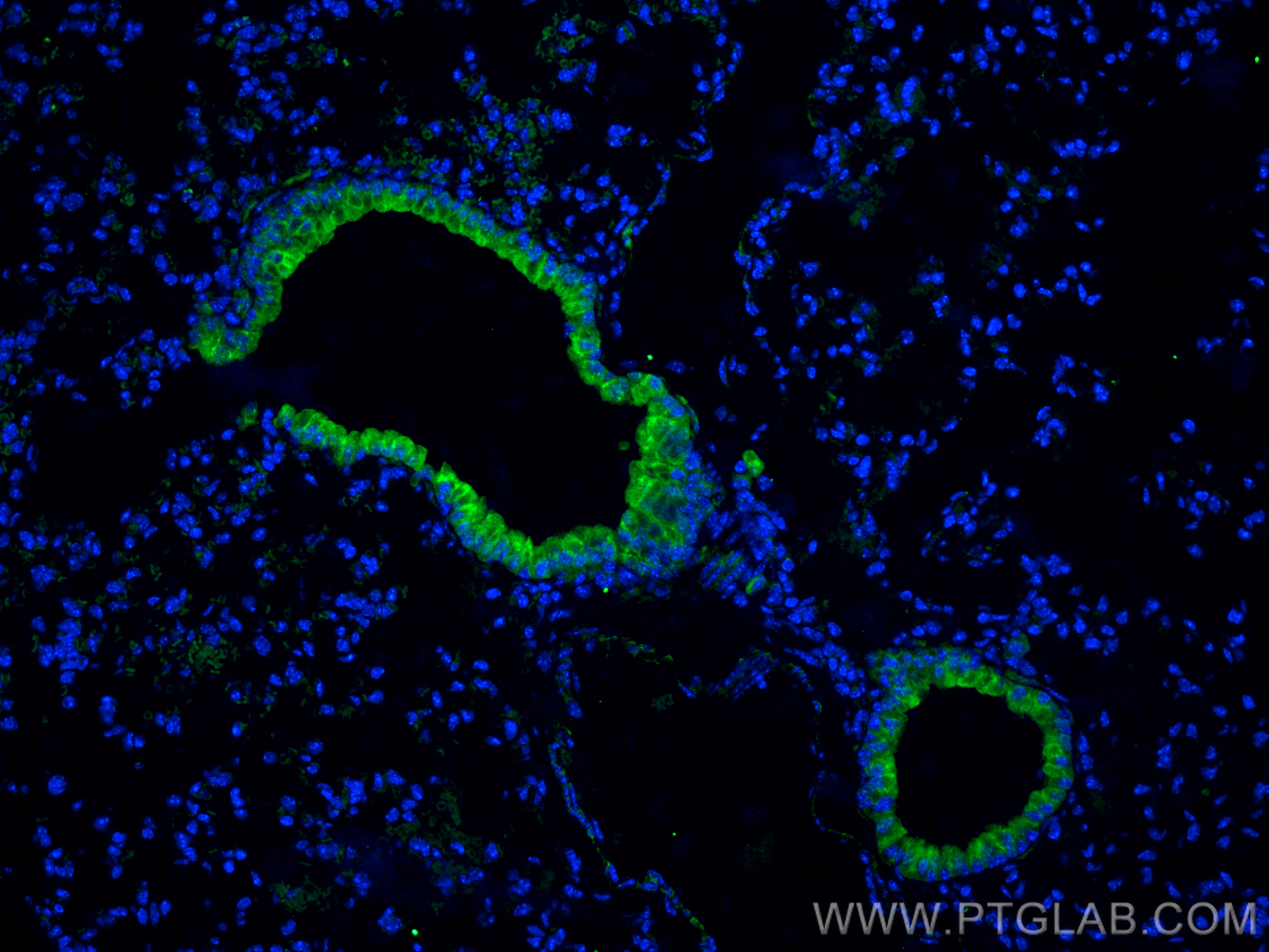 Immunofluorescence (IF) / fluorescent staining of mouse lung tissue using SPTA1 Polyclonal antibody (55227-1-AP)