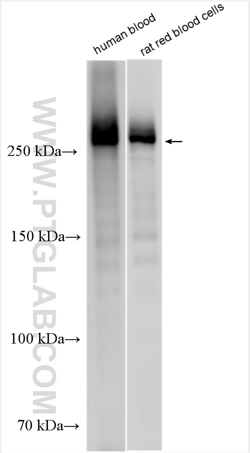 Western Blot (WB) analysis of various lysates using SPTA1 Polyclonal antibody (55227-1-AP)