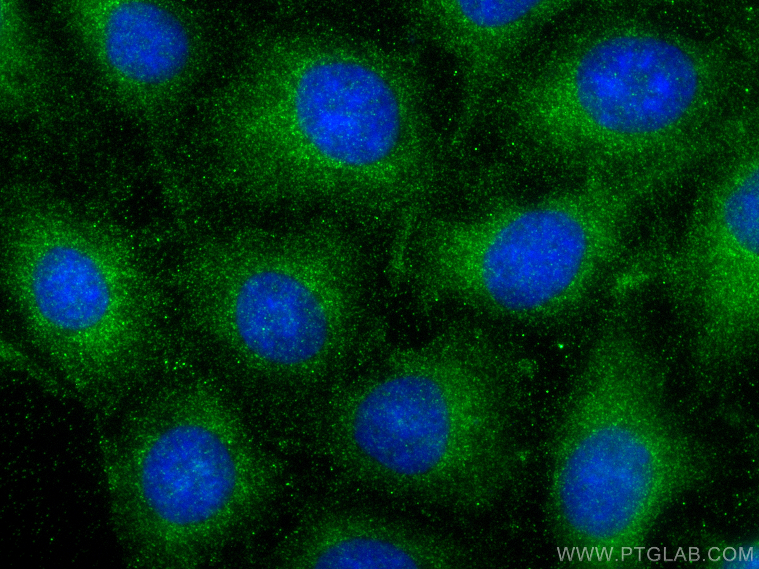 Immunofluorescence (IF) / fluorescent staining of U2OS cells using SPTB Polyclonal antibody (26936-1-AP)