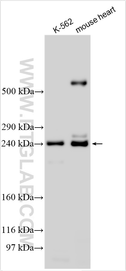 Western Blot (WB) analysis of various lysates using SPTB Polyclonal antibody (26936-1-AP)