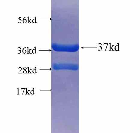 SPTB fusion protein Ag25614 SDS-PAGE