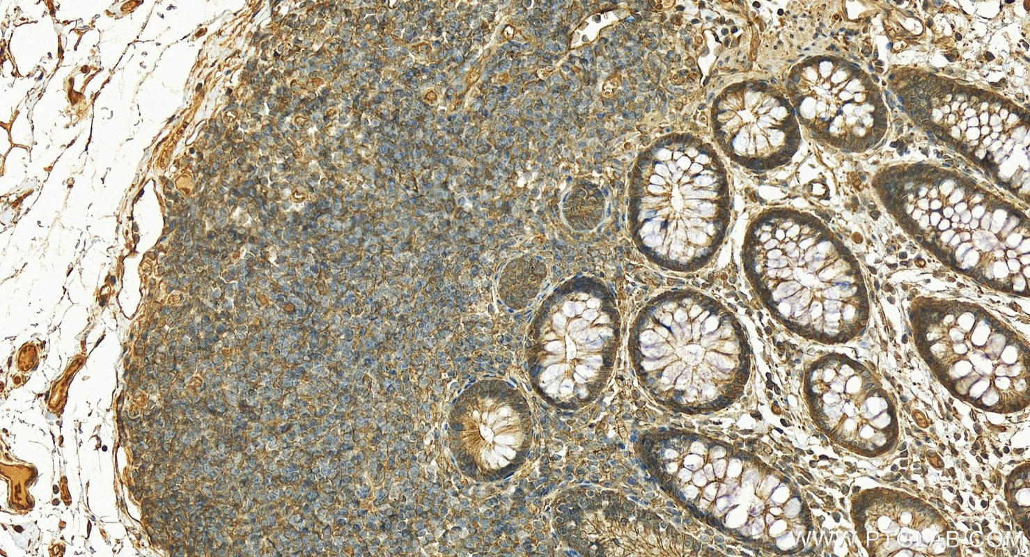 Immunohistochemistry (IHC) staining of human normal colon using SPTBN1-Specific Polyclonal antibody (19722-1-AP)