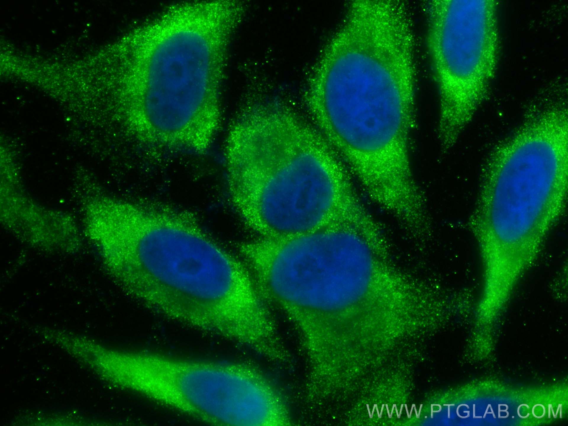 Immunofluorescence (IF) / fluorescent staining of HepG2 cells using SQRDL Monoclonal antibody (68459-1-Ig)