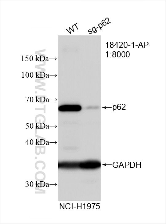 Western Blot (WB) analysis of NCI-H1299 cells using P62/SQSTM1 Polyclonal antibody (18420-1-AP)
