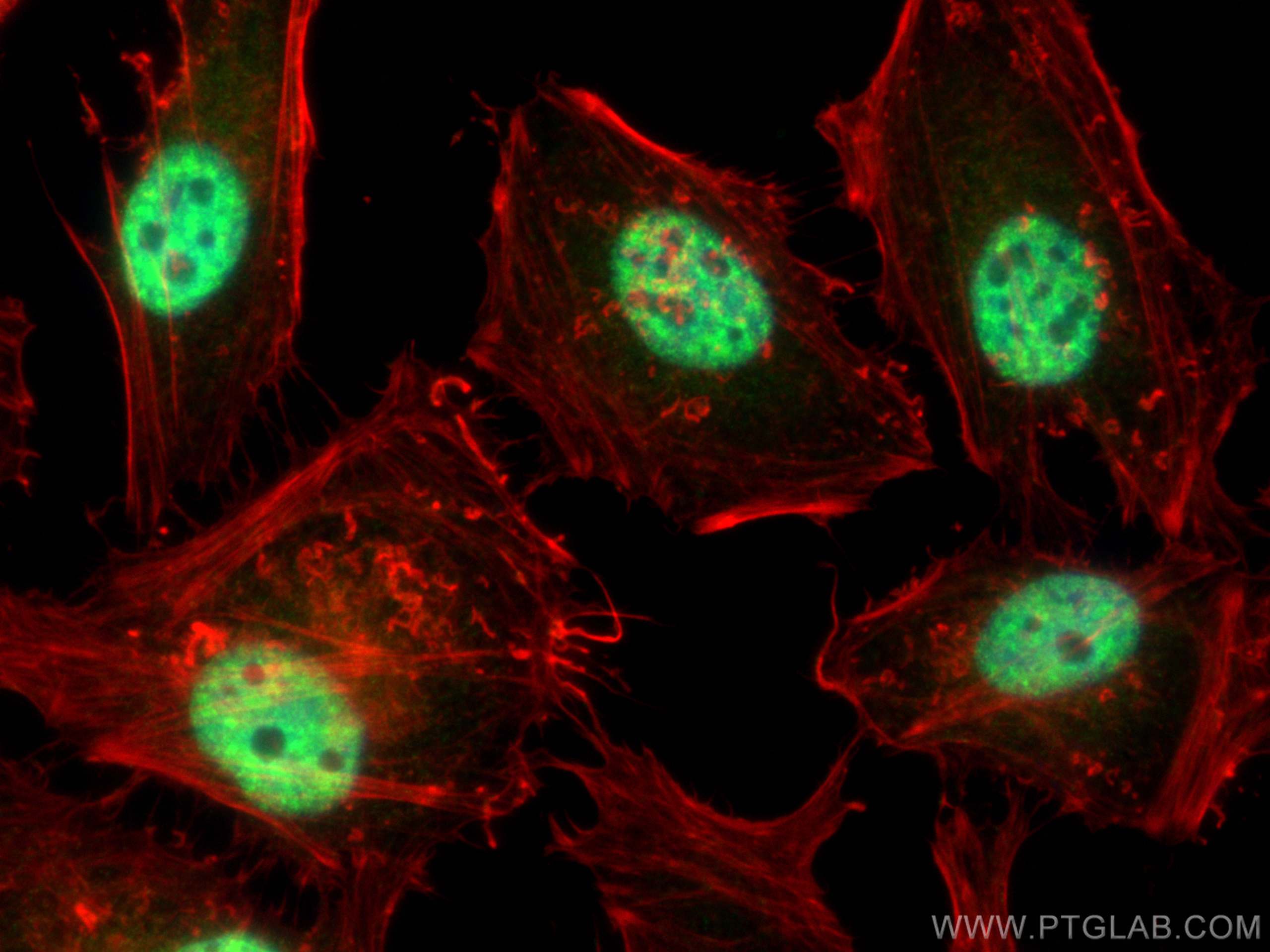 Immunofluorescence (IF) / fluorescent staining of HeLa cells using SR140 Polyclonal antibody (21399-1-AP)