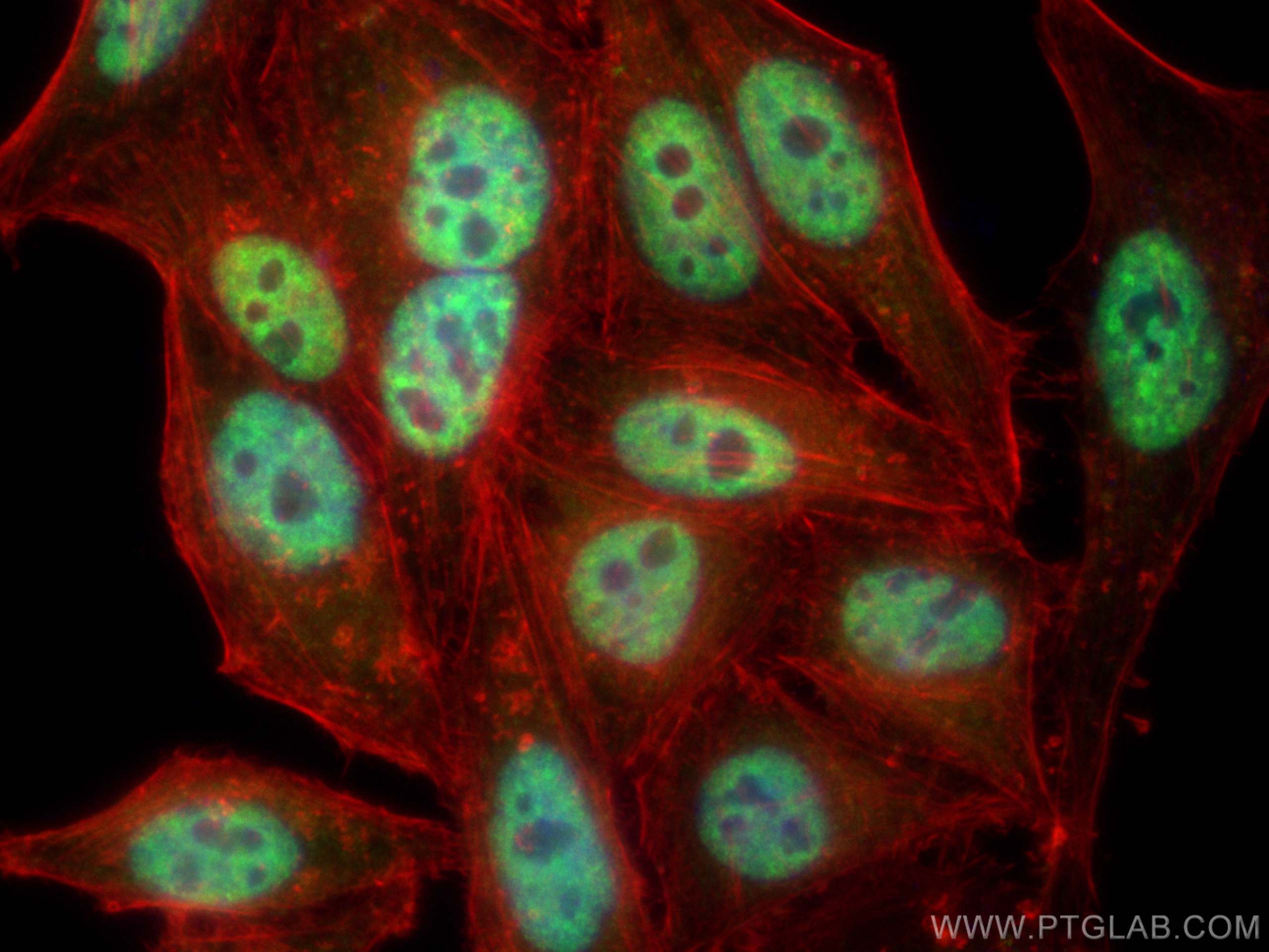 Immunofluorescence (IF) / fluorescent staining of HepG2 cells using SR140 Polyclonal antibody (21399-1-AP)