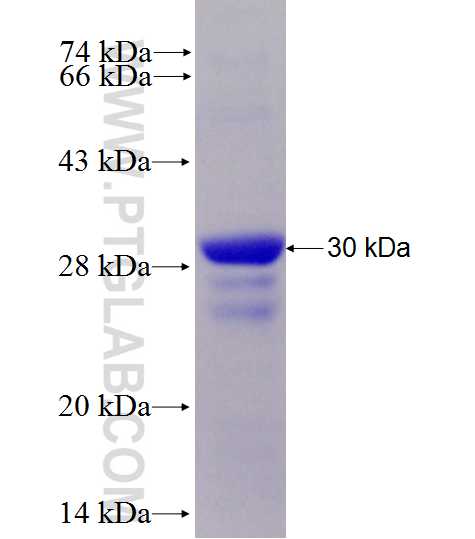 SRA1 fusion protein Ag28150 SDS-PAGE