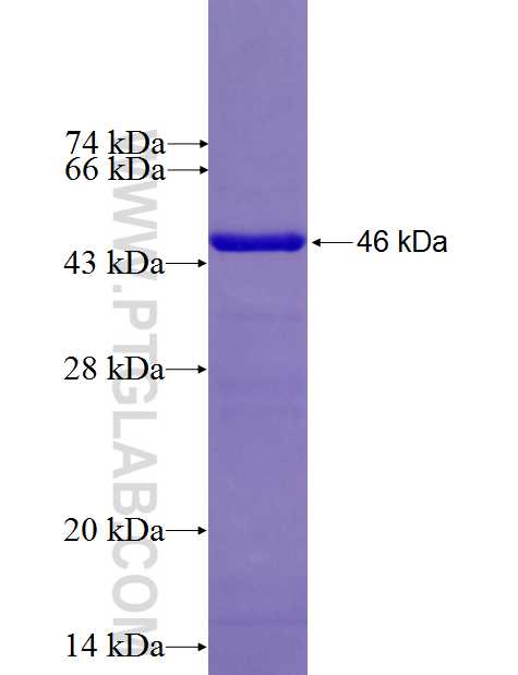 SRD5A2L2 fusion protein Ag26831 SDS-PAGE